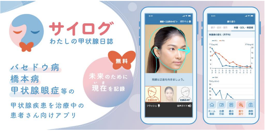 サイログ画面 